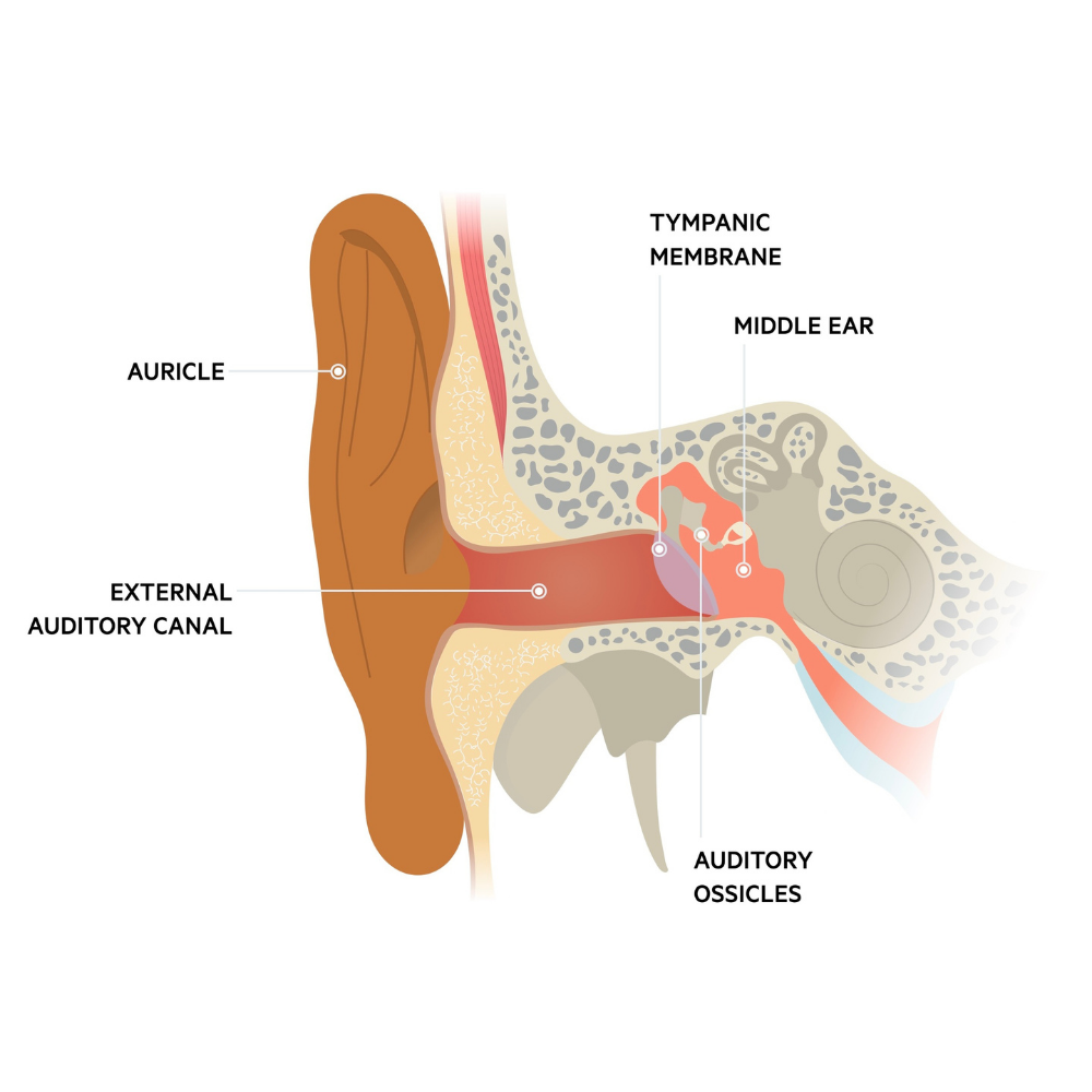 acute otitis media